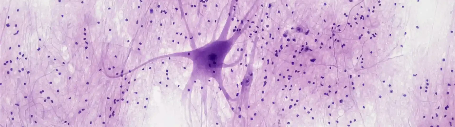 Depression durch Vitaminmangel